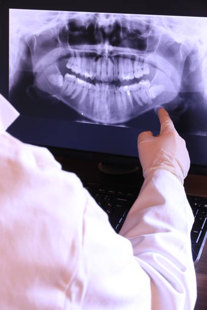 Best Root Canal Emergency Dentist  in Kermit, TX